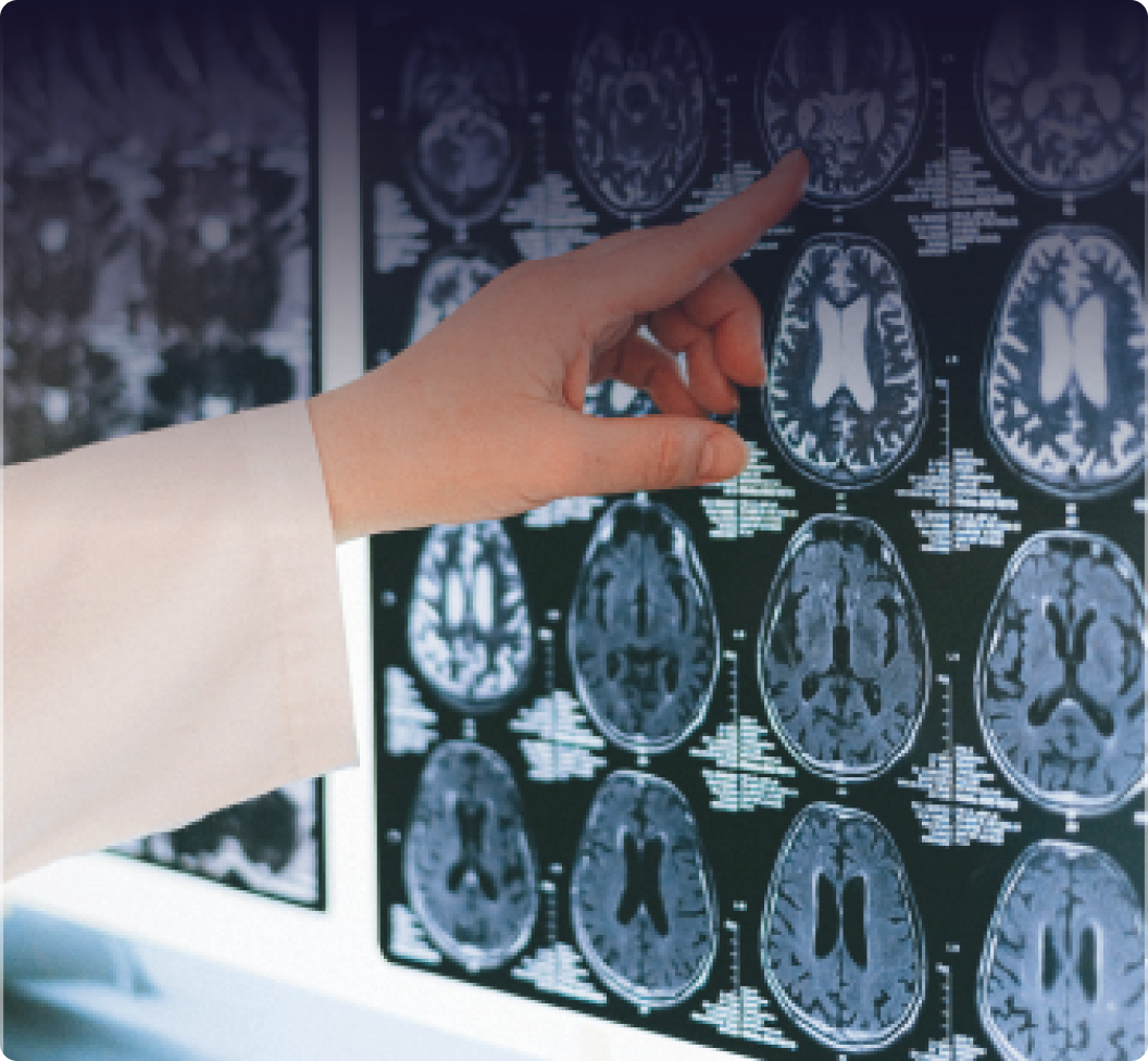 Médecin pointant des IRM cérébrales